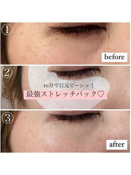 スワロ 奈良西大寺店(Swallow)/最強！アイストレッチパック★