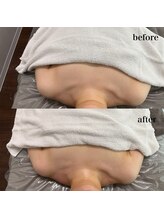 ベール(BEHL)/コルギのBefore After