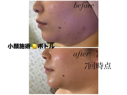 マスカレード(Masquerade)の写真