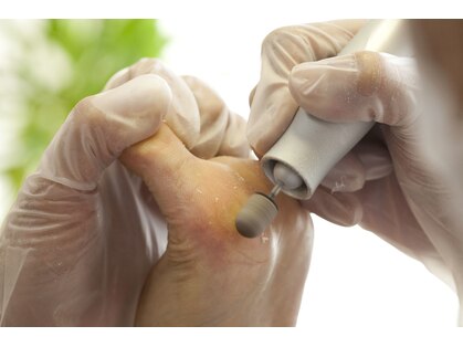 ブルーム(bloom)の写真