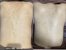 フルール(Fleur)/■背中トリートメント■