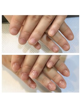 リーフ(Leaf)/自爪形成カラー仕上げ