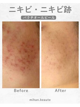 ミハン ボーテ(mihan.beaute)/