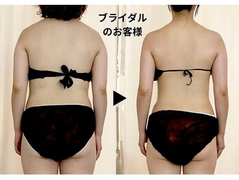 ディアメデル(Diamedel)/