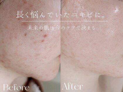 ウィハナ(wehana)の写真