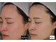 ロペス(Lopez)の写真