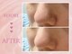 クリアラボ 上野(Clear Lab)の写真/【韓国式肌管理】[韓国式毛穴洗浄¥6000～]内側から発光するような艶肌になれる♪透明感溢れる水光&美白肌に