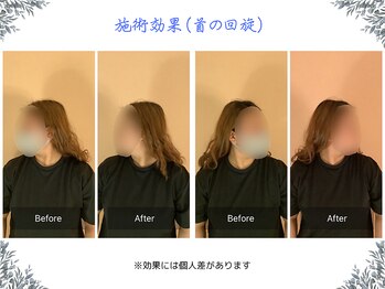 ボディ リセット アンド デザイン(Body Reset & Design)/【施術例】ビフォーアフター