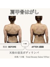 トータルビューティーサロン ヴィヴィエ(ViVier)/肩甲骨剥がし