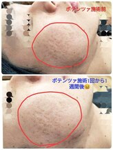 縁(en)/ポテンツァ　