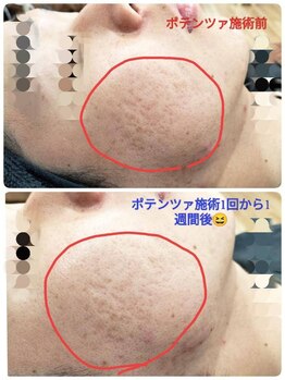 縁(en)/ポテンツァ　