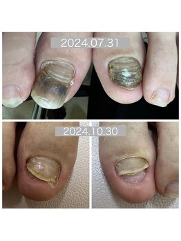 エラン(elan)/nail care