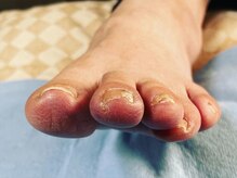 自分では難しい足のケアはプロにお任せ！