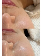 ウララカ(uraraca)/一度で変わります。