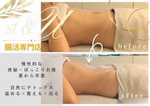 エスティーアンドユー(st&U)