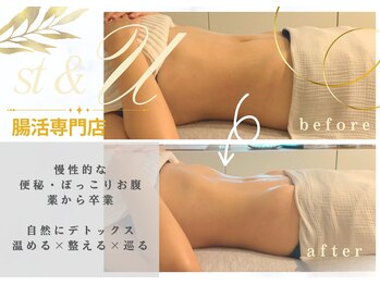 エスティーアンドユー(st&U)