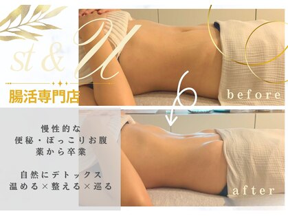 エスティーアンドユー(st&U)の写真