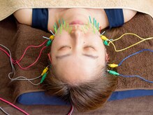 ビーフラット(B-flat)の雰囲気(美容鍼)