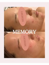 メモリー(MEMORY)/肌質改善☆