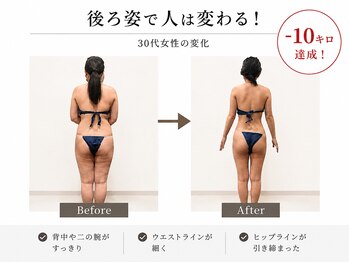 エステティックサロン サロン ド ヴィーナス 新宿店/30代お客様の変化写真