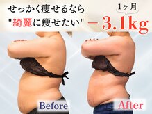 イストアールエム(HISTOIRE.M)の雰囲気（痩身エステ×筋膜リリース【お試し】でまずは体験！）