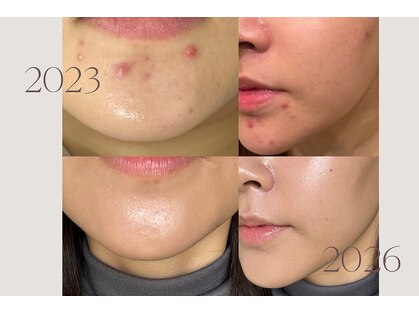 ジーニー(JINNY)の写真