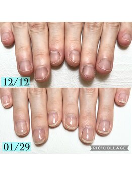 シャルム 本厚木(charme)/深爪緩和