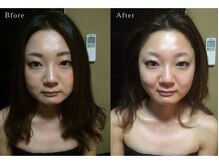 グレースフィオーレ 町田店(gracefiore)/お客様のビフォーアフターその3