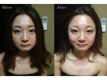 グレースフィオーレ 町田店(gracefiore)/お客様のビフォーアフターその3