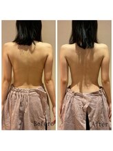 オクノマ(OKUNOMA)/【お客様BeforeAfter】