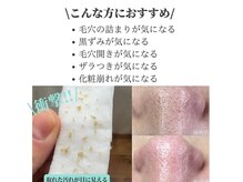 リッカロッカ(RIKKA&ROCCA)/肌質改善まずは毛穴から！