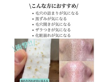 リッカロッカ(RIKKA&ROCCA)/肌質改善まずは毛穴から！