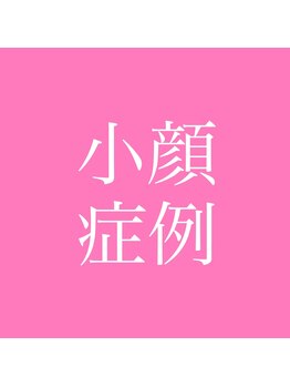 リープ(Lieb)/小顔　ビフォーアフター