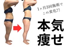 ヘッテ(Hette)