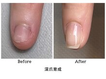 アンベリール(embellir.)/噛爪から美爪へ