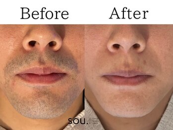 ソウ 越前店(sou.)/