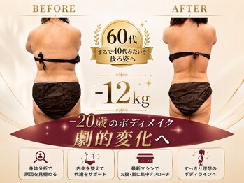 プシュケ(PSYCHE)の写真/◎60代からまるで40代の後ろ姿へ。
　－12キロ劇的ボディメイク◎