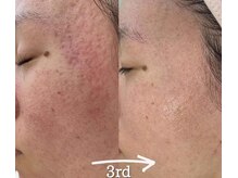 アリアンド(ari.and)の雰囲気（結果重視！長年積み重ねた肌悩み、ご相談ください）