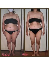 ダイエットルーム リ ボーヌ(Re Bornu)/・40代　全身半身メディセル32回