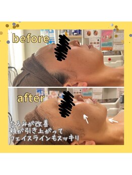 アミュレット(amulette)/【光フォト/エイジングケア】