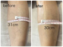 チル アンド リラックス(Chill and Relax)/むくみ解消