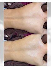 ヒーリングハーツ(Healing Hearts)/ブライダル・ボディーケアに！