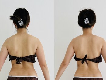 ルナフルール(Luna Fleur)/いたくない筋膜リリース