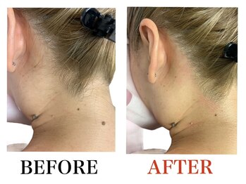 ブリリアンス(BRILLIANCE)/