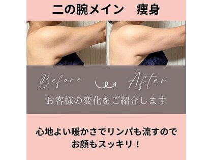 アクア(akua....)の写真
