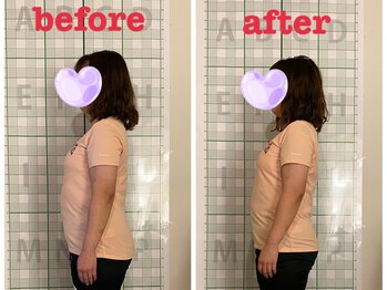 アンムート(anmut)/1度の施術で姿勢改善!