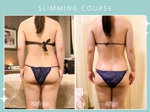 ハノハノ 八代店(HANO HANO)/選べる12種の痩身脂肪撃退☆