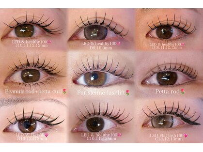 ケトメ(ketome)の写真