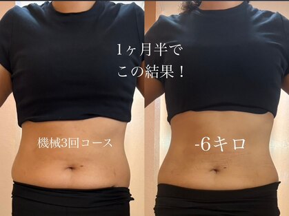 リノレア(Lino_Lea)の写真