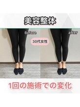 シオ 横浜関内(sio)/施術後の変化BeforeAfter